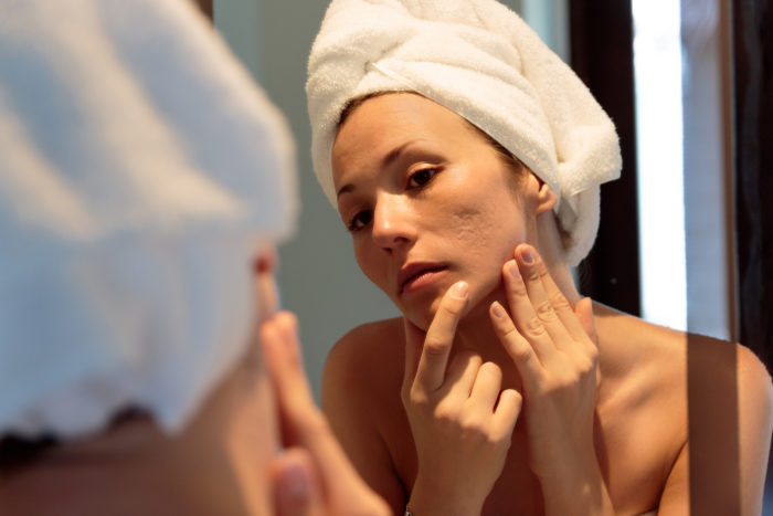 treat acne scarring with facial rejuvenation in Hamilton New Jersey